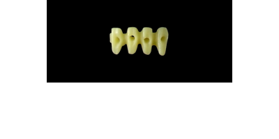 Cod.E12 f Lower Anterior : 10x  hollow pontics blocks-frames, (42-32), carved to fit into wax veneers Cod.E12Lower Anterior, SMALL, (43-33), for porcelain pressed to metal bridgework